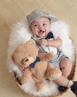 Baby with cleft palate, smiling and holding teddy bear