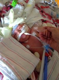 Newborn with medical equipment