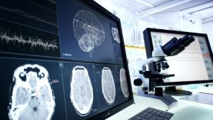 Brain scan imaging on computer screen