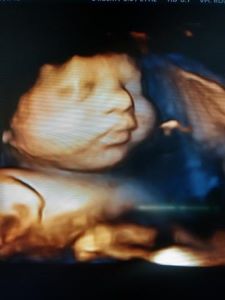 3D image of baby in utero