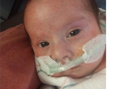 Closeup of infant with nasal tubes in place