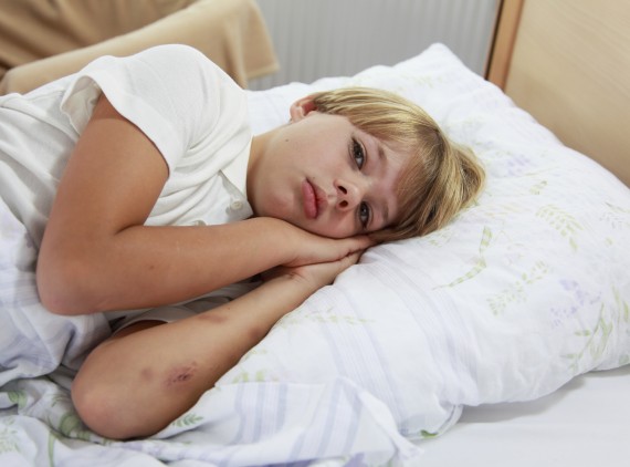 Sick child in bed with bruises on arms