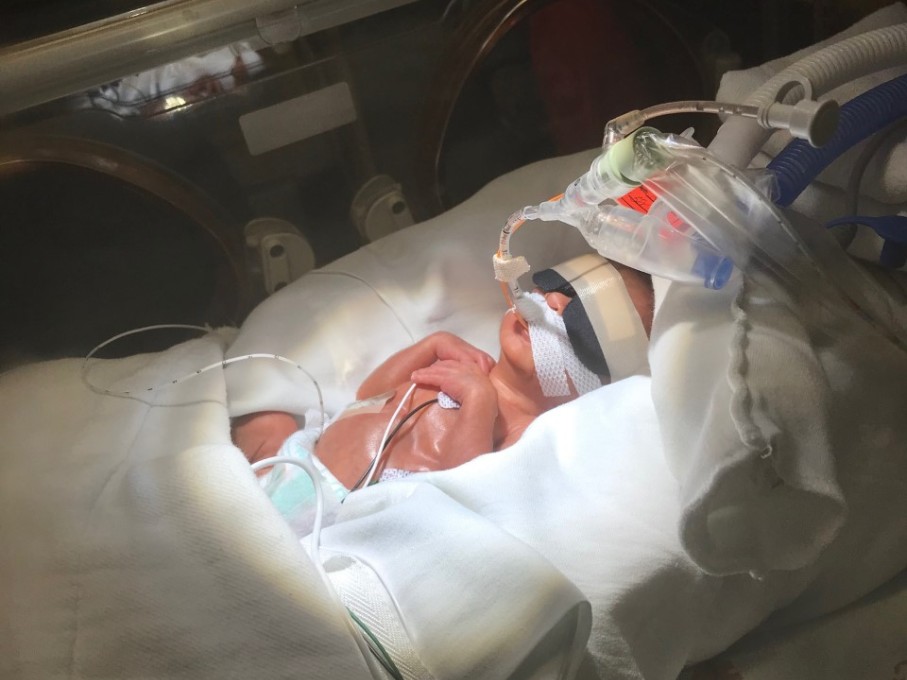 Newborn preemie in incubator