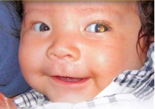 Baby with a glow in their eye