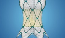 Artist rendering of Harmony mesh