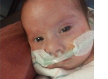 Closeup of infant with nasal tubes in place